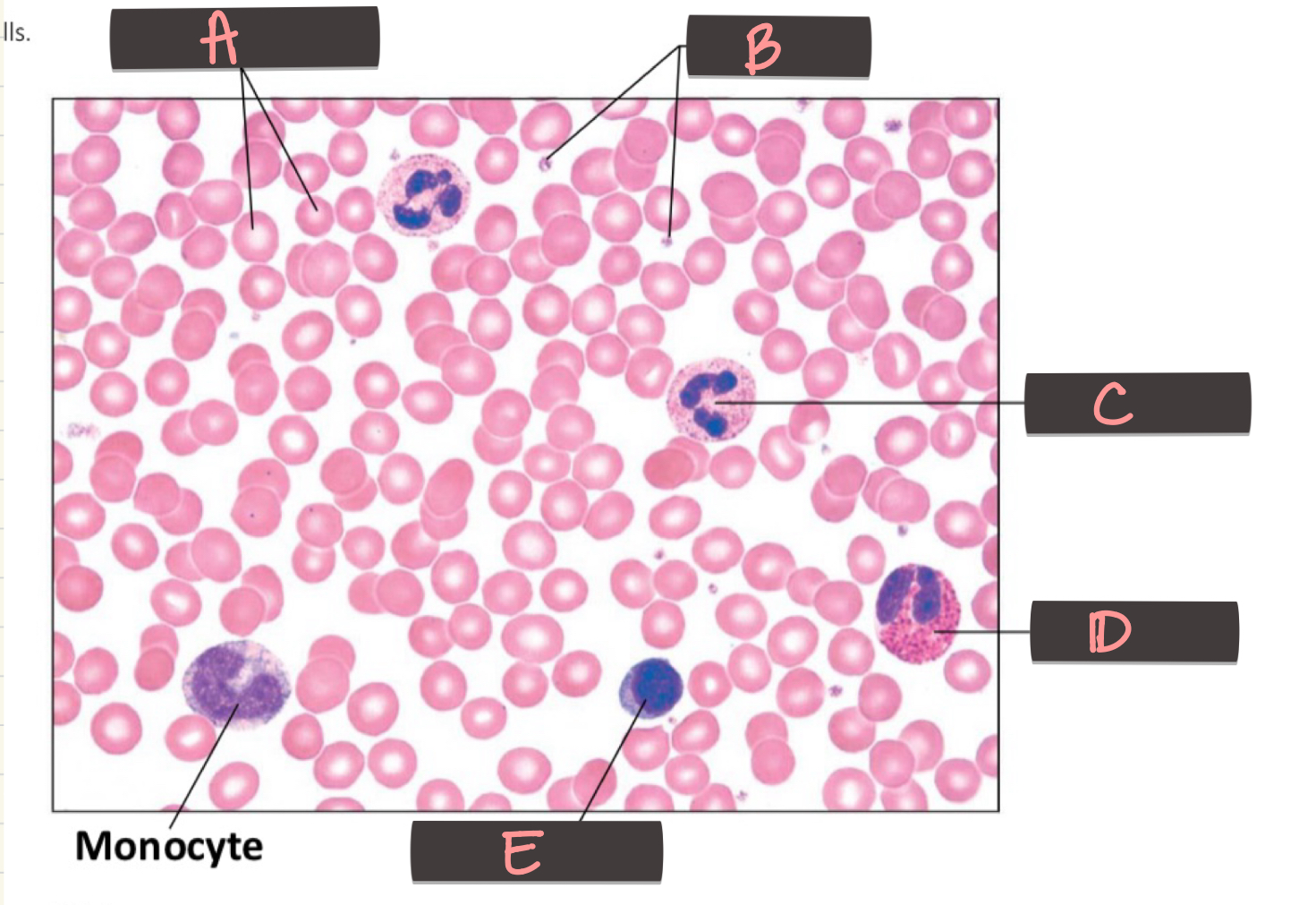 <p>Monocyte</p>