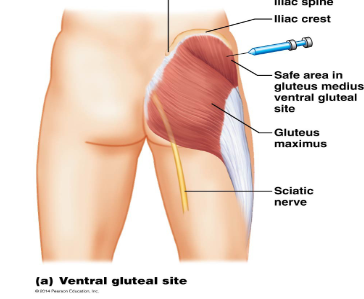<p>Gluteal injection</p>