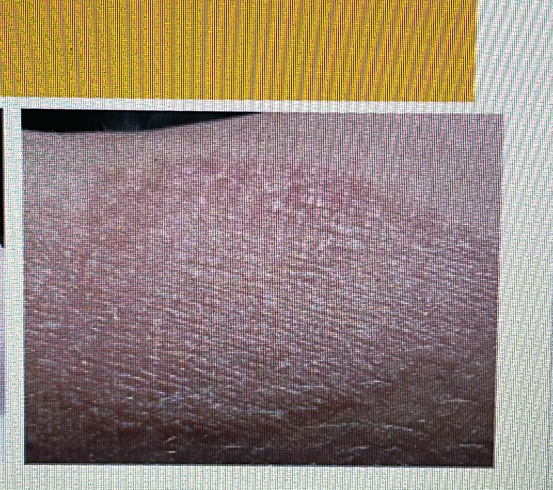 <p>dry skin rash</p>