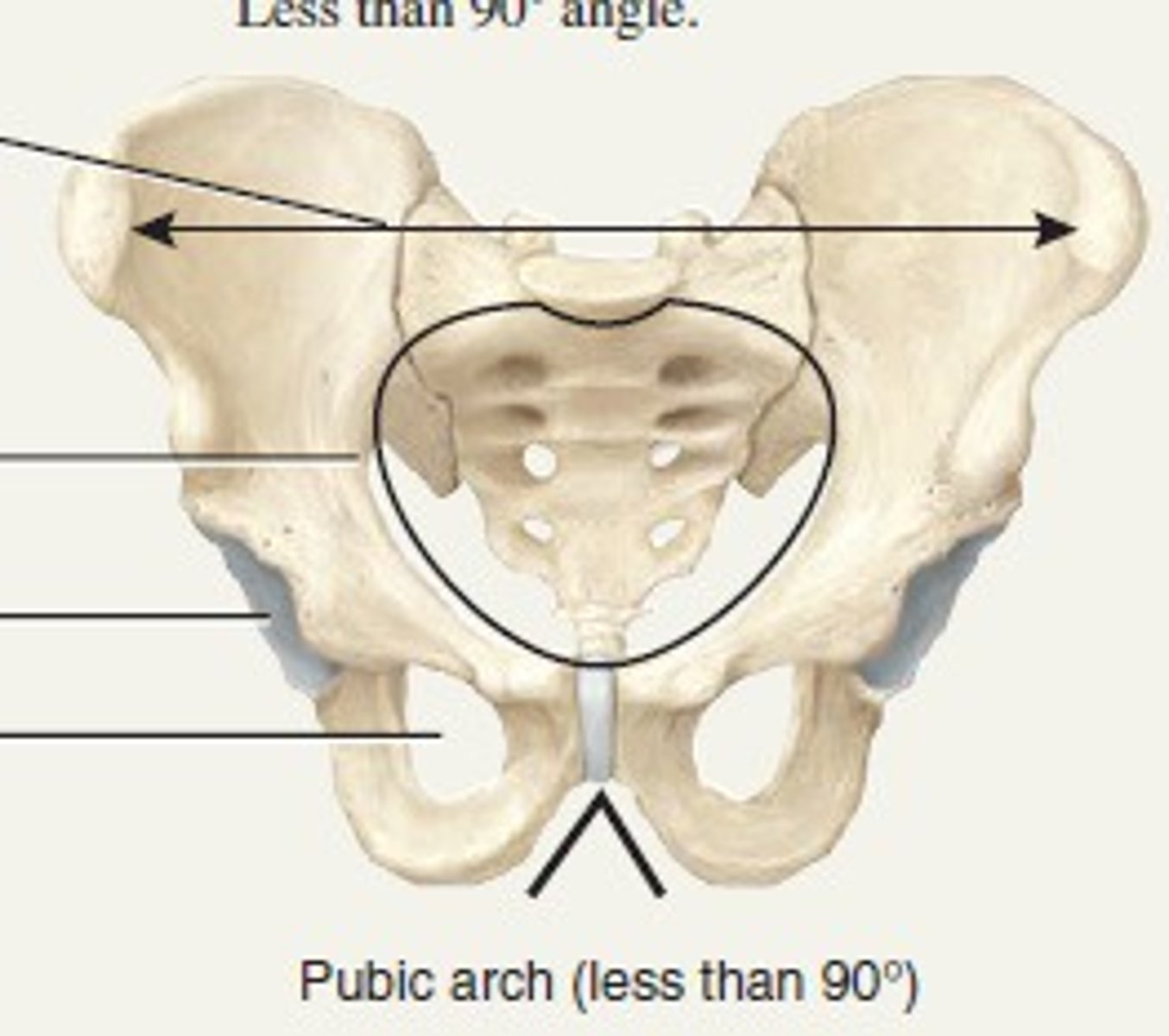<p>small sciatic notch<br>tall slender pelvic girdle<br>narrow pelvic inlet<br>pelvic arch about 90 degree angle</p>
