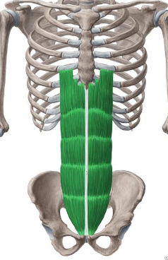 <p><strong>Origin</strong>: Pubis crest, Pubic symphysis</p><p><strong>Insertion</strong>: Ribs(5-6) &amp; Xiphoid Process</p><p><strong>Action</strong>: Trunk flexion with resistance, accessory respiratory muscle</p>