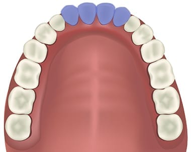 <p>Incisors </p>