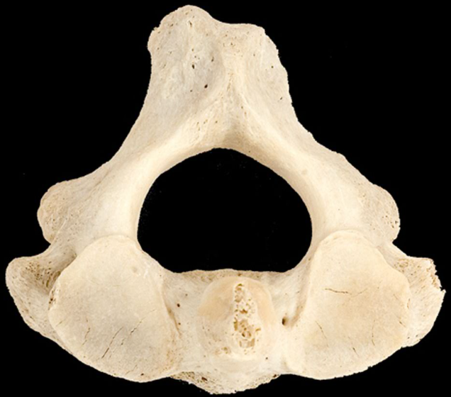 <p>Which bone is this?</p><p>(Superior view).</p>