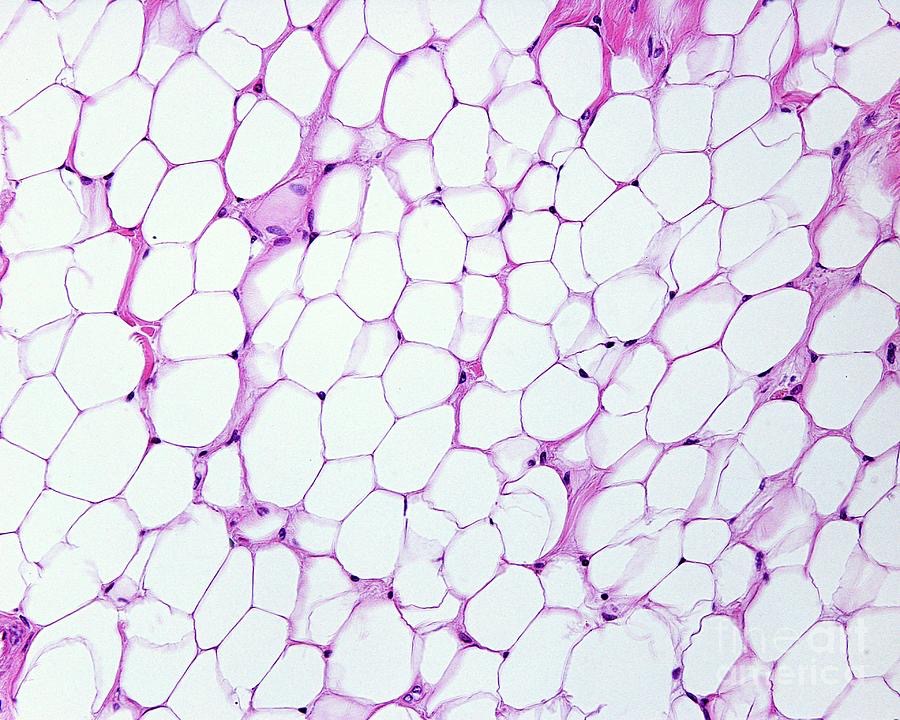 <p>Adipose Tissue (fat)  - Loose Connective Tissue </p>