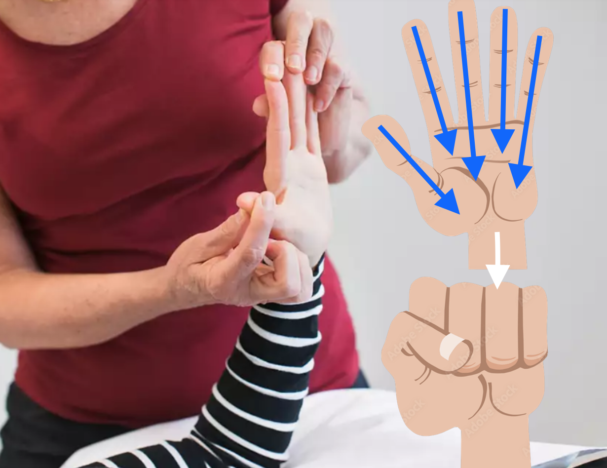 <p>Böj och sträck fingrarna genom att “rulla” ihop handen.</p><p>(Från öppen hand till knuten näve) </p><p>Kon ihåg att sträcka ut hela fingret, glöm inte DIP-lederna</p><p>Gör tummen separat eftersom att den är lite trixig att göra tillsammans med de andra fingrarna</p>