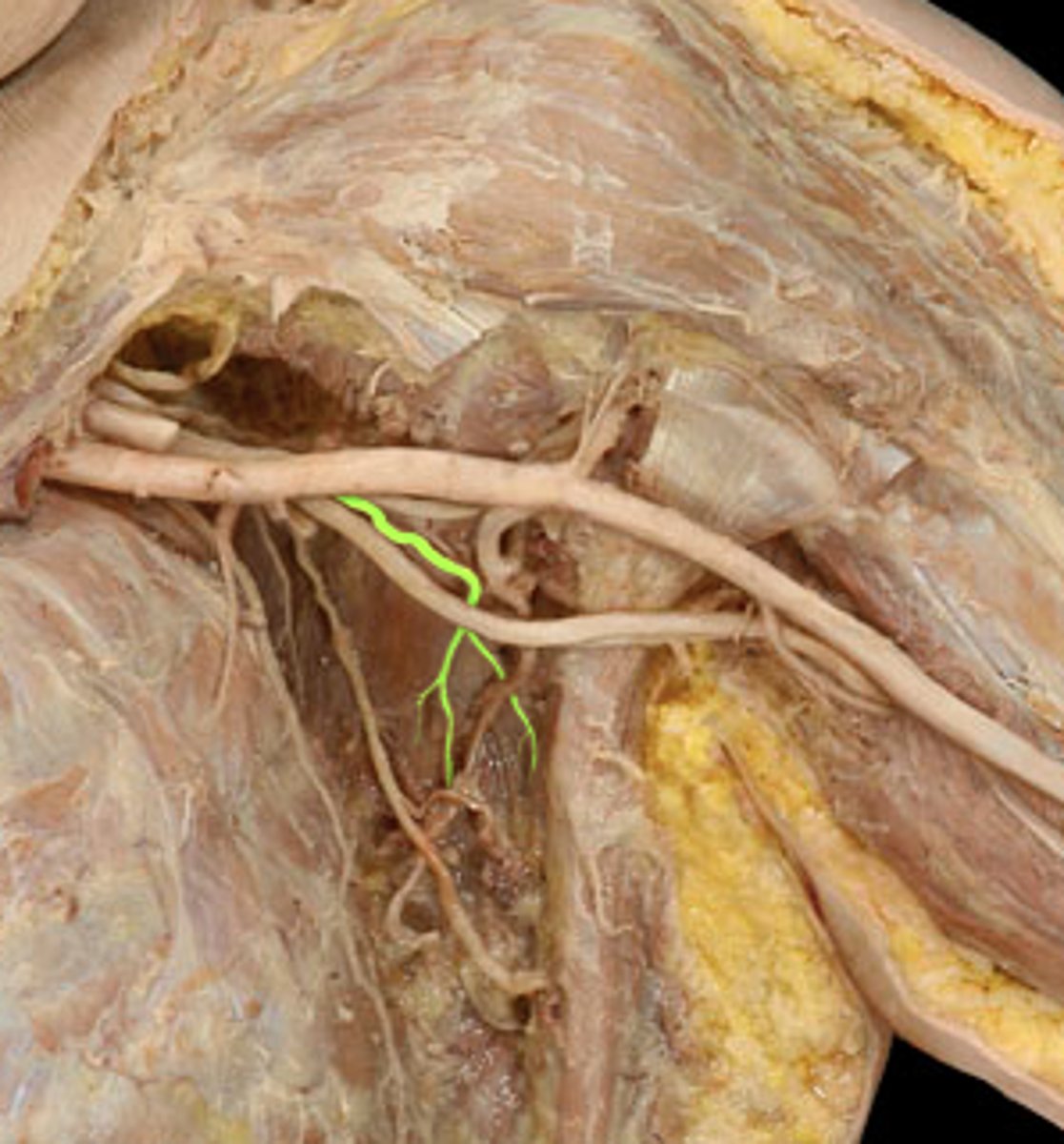 <p>subscapularis &amp; teres major innervating nerve...</p>