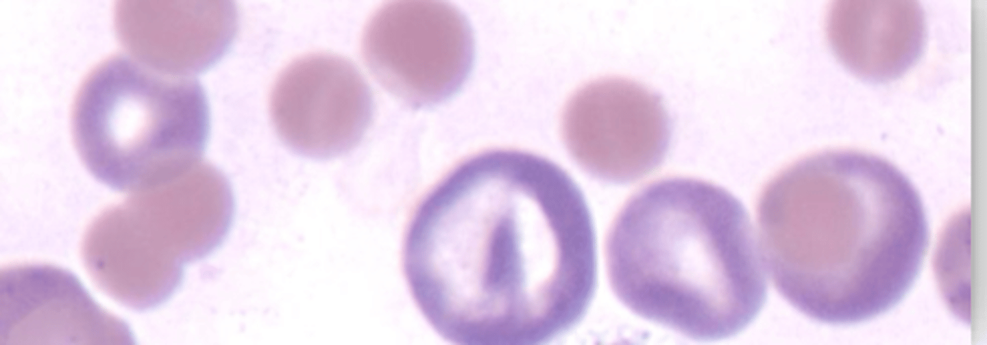 <p>What will you see in a canine and feline w/ regenerative anemia?</p>