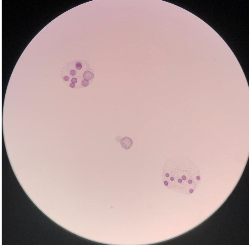 <p>Type of chlorophyte</p><p>Motile colonial green algae - hundreds to thousands of haploid cells in a gel matrix</p><p>Asexual reproduction - vegetative with daughter colonies forming inside parent colonies</p><p>Sexual reproduction - at the end of the growing season forms gametes; dormant zygotes undergo meiosis before germination</p>