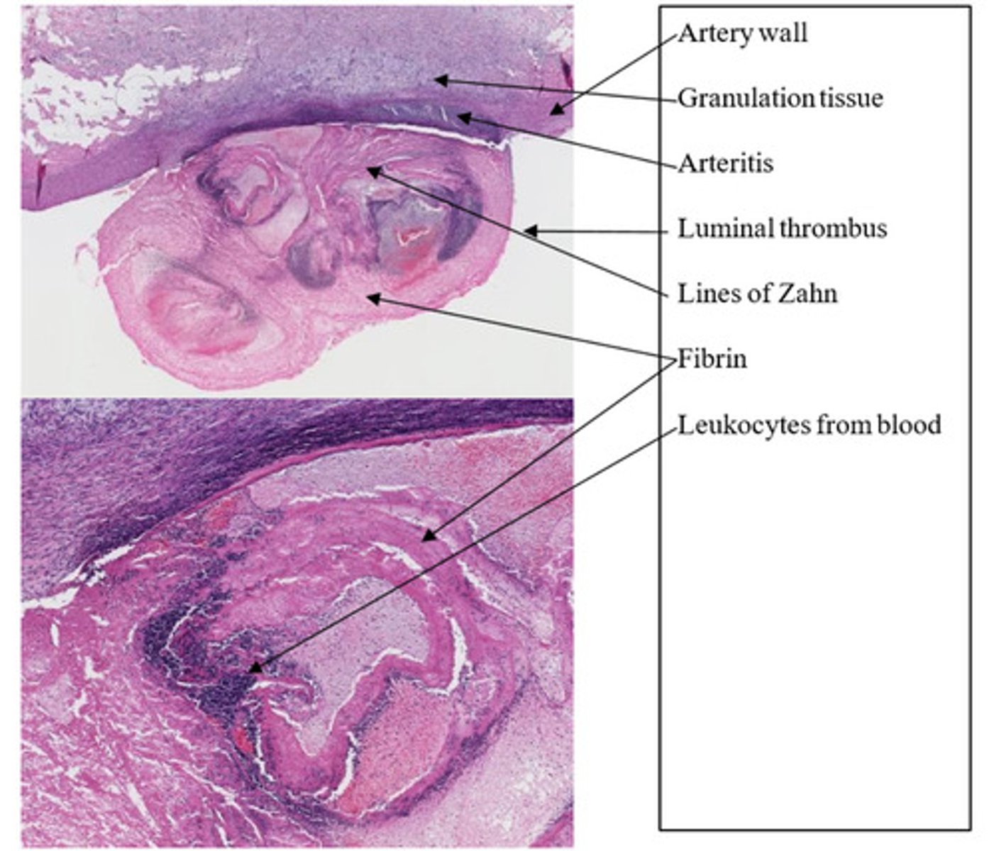 <p>What is the lesion?</p>