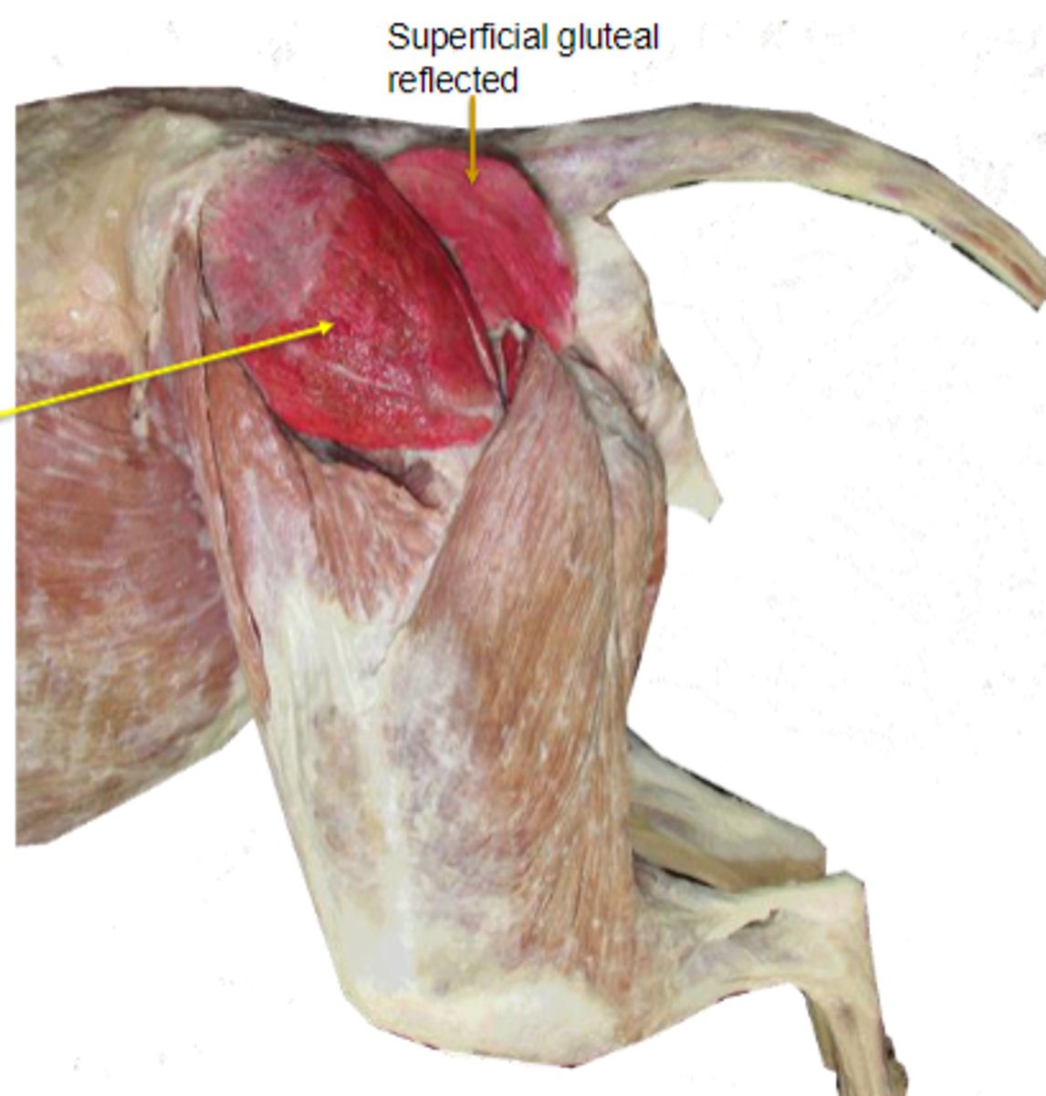 <p>What muscle is shown?</p>