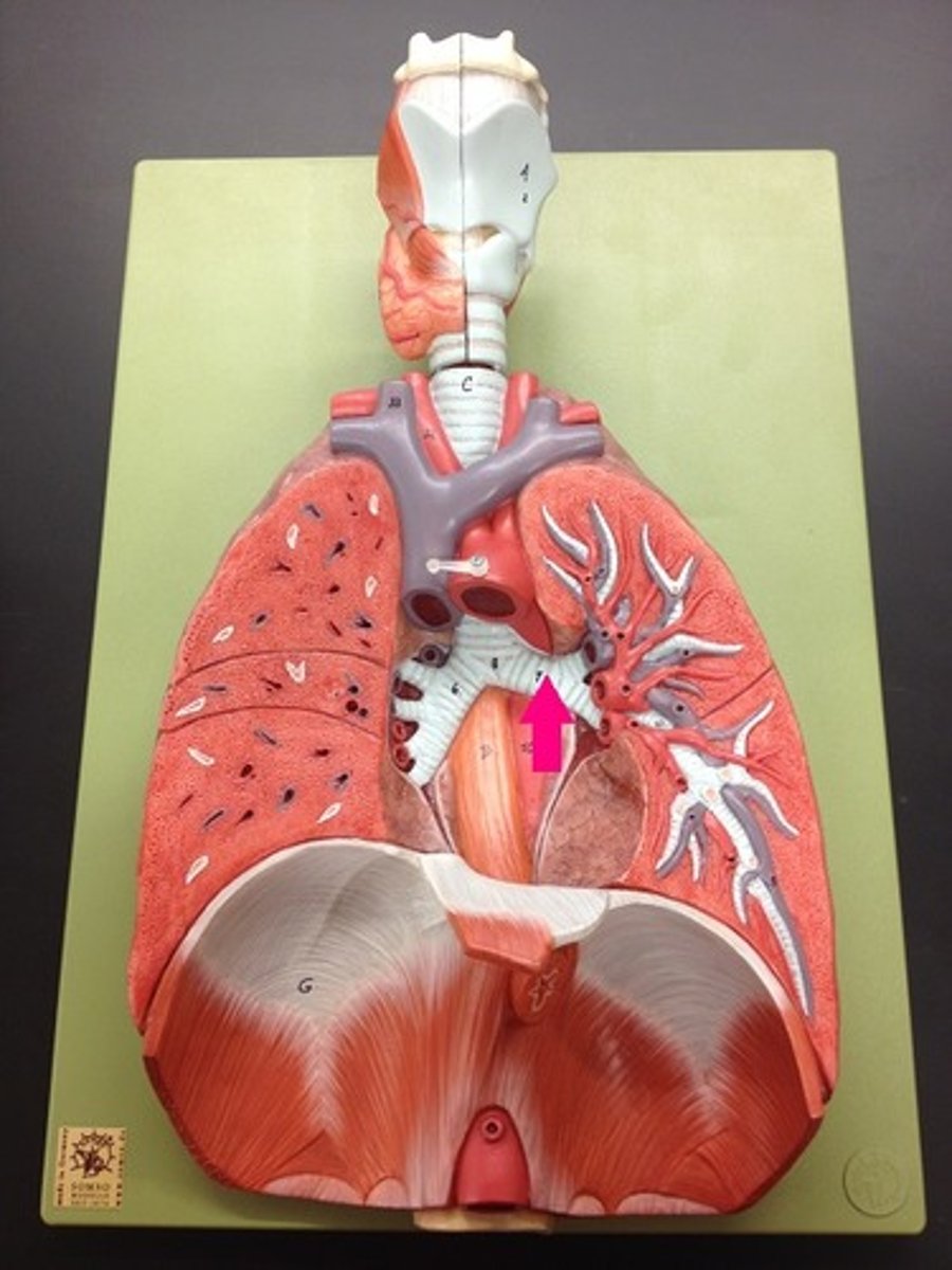 <p>Identify the structure (include left or right).</p>
