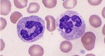 <p>Identify this leukocyte </p>