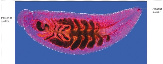 <p>Domain Eukarya</p><p>Phylum Annelida<br>Class - Hirudinea(Leech)</p>