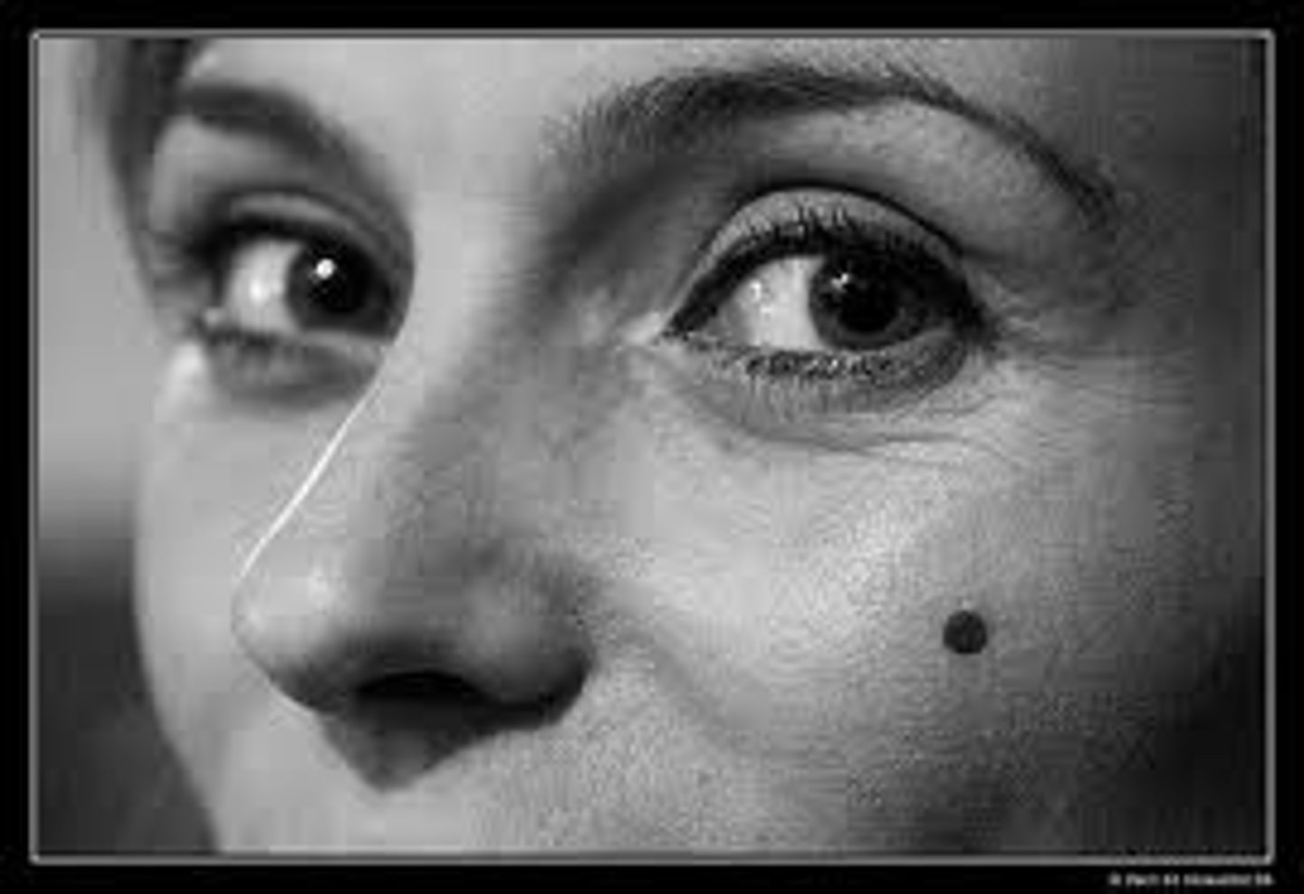 <p>mole/ beauty mark</p>