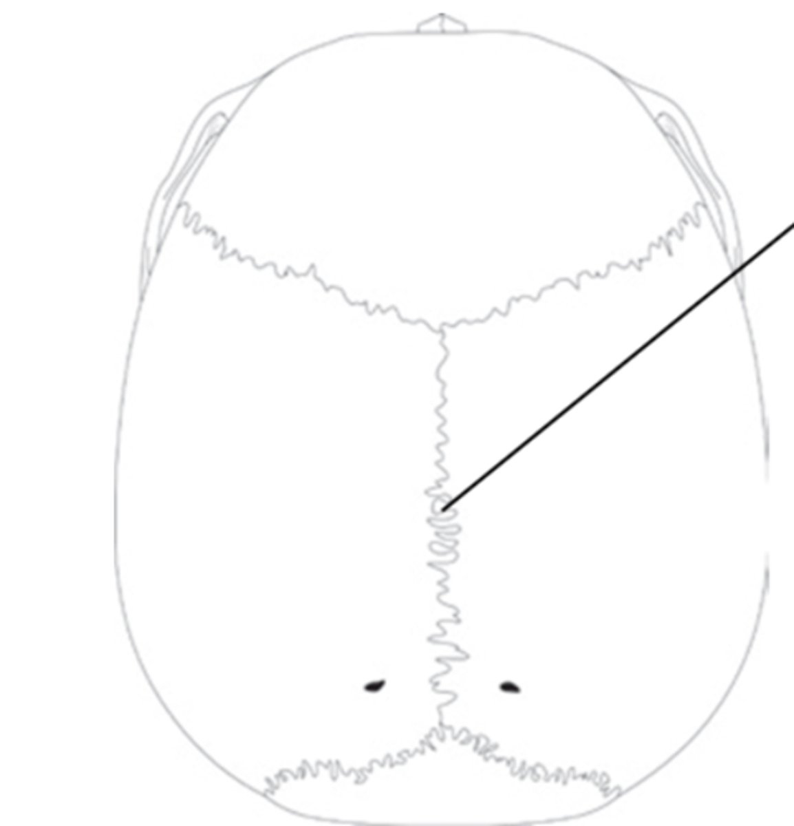 <p>What is the functional classification of this joint?</p>