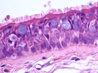 <ul><li><p><span>Sits posterior to the esophagus</span></p></li><li><p><span>Purple is the thick band of purple</span></p></li><li><p><span>Epithelium is the cells lining the trachea</span></p></li><li><p><span>Simple, columnar cells with cilia</span></p></li><li><p><span>Pseudostratified epithelium</span></p></li></ul><p></p><ul><li><p>cilia sweeps the mucus up </p></li></ul><p></p>