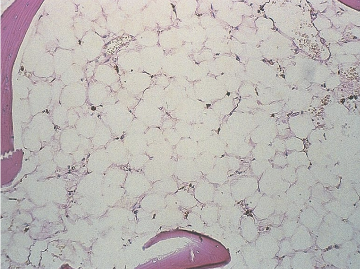 <p>classify the cellularity. include ratio.</p>