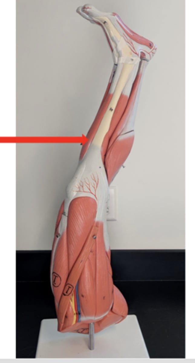 <p>what is this?</p>