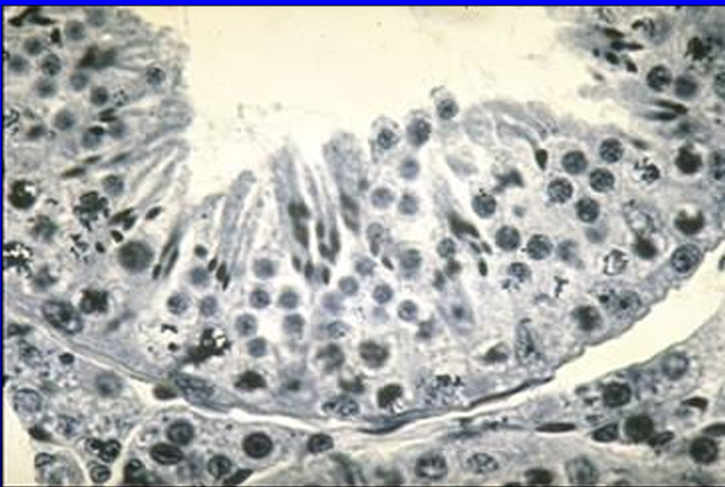 <p>Identify the structure:</p><p>Specie:</p><p>Stain used:</p>