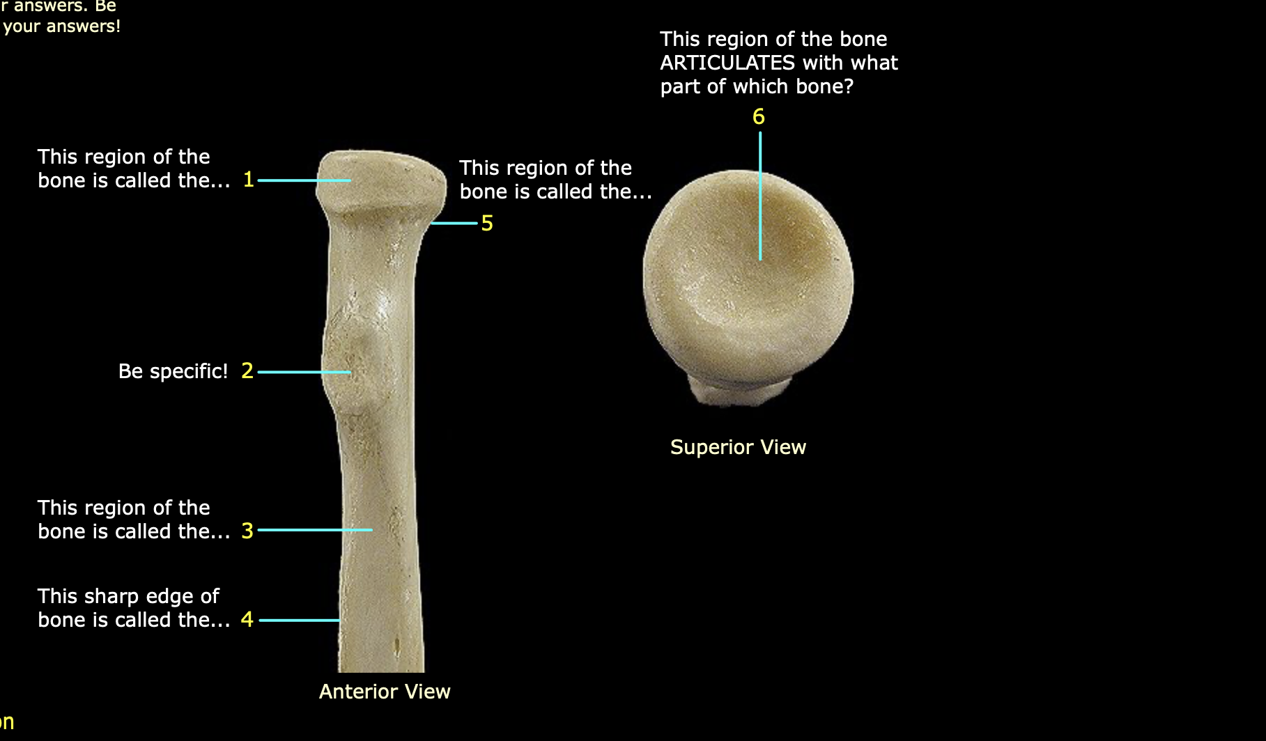 <p>What bone is this? What structure is 2?</p>