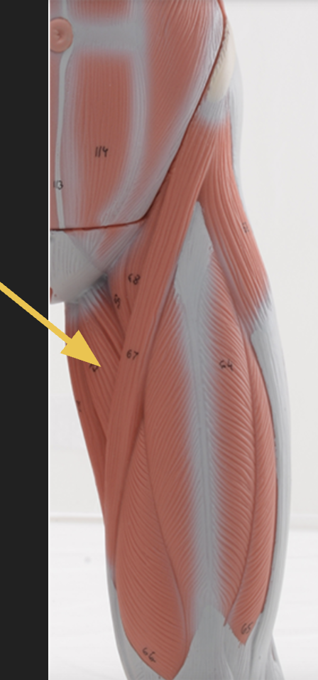 <p>identify + state origin, insertion, action, innervation of marked structure</p>