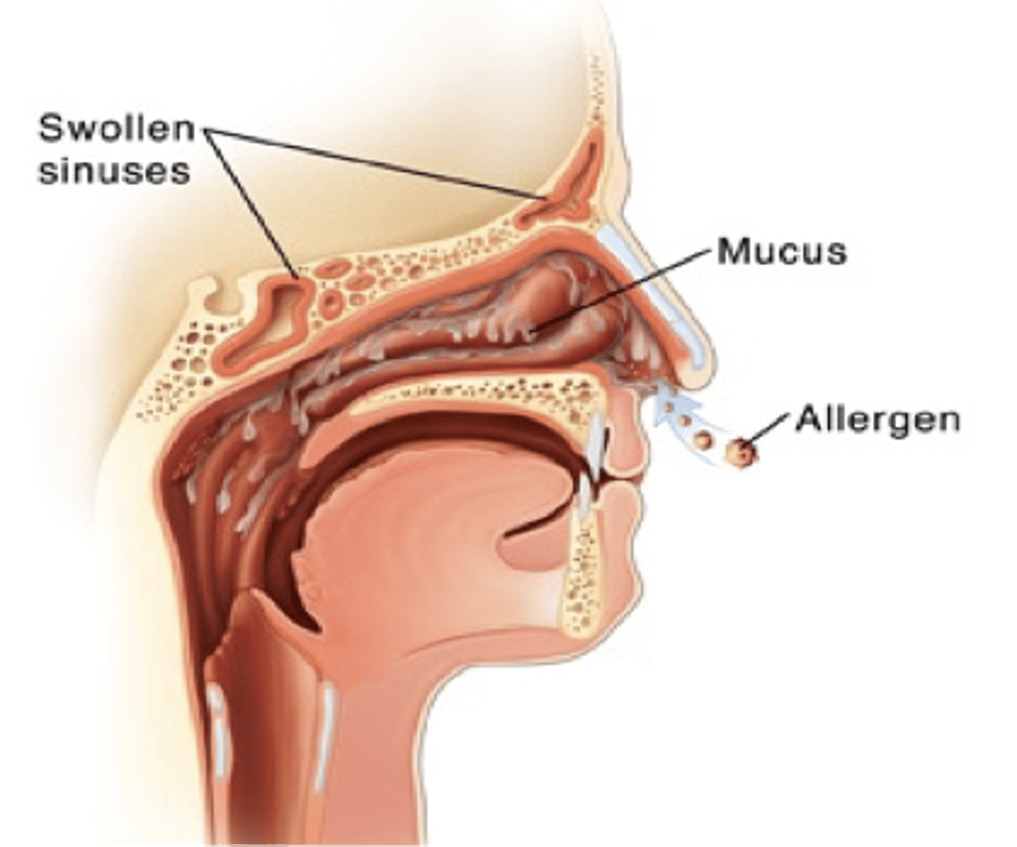 <p>Once an allergen enters, the allergen will trigger us to have extra mucus</p>