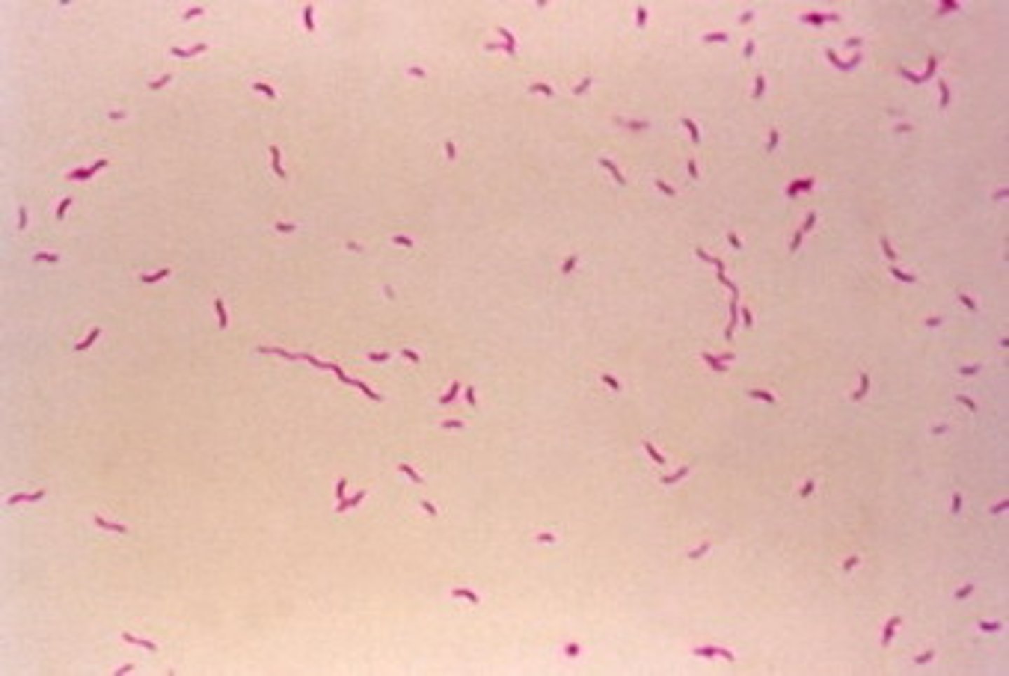<p>Gram negative spiral rods</p><p>Affects the gastrointestinal system</p><p>Causes diarrhoea with mucus or blood</p><p>Zoonotic</p>