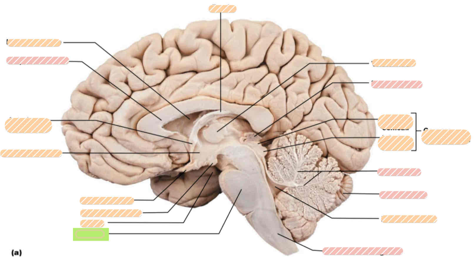 <p><span>Human brain</span></p>