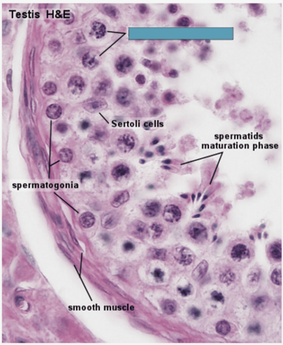 <p>Identify the cells</p>
