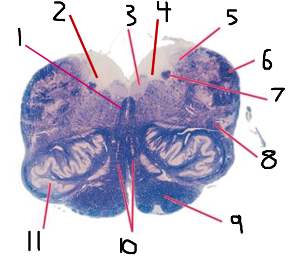 <p>(4) #7 is the:</p>
