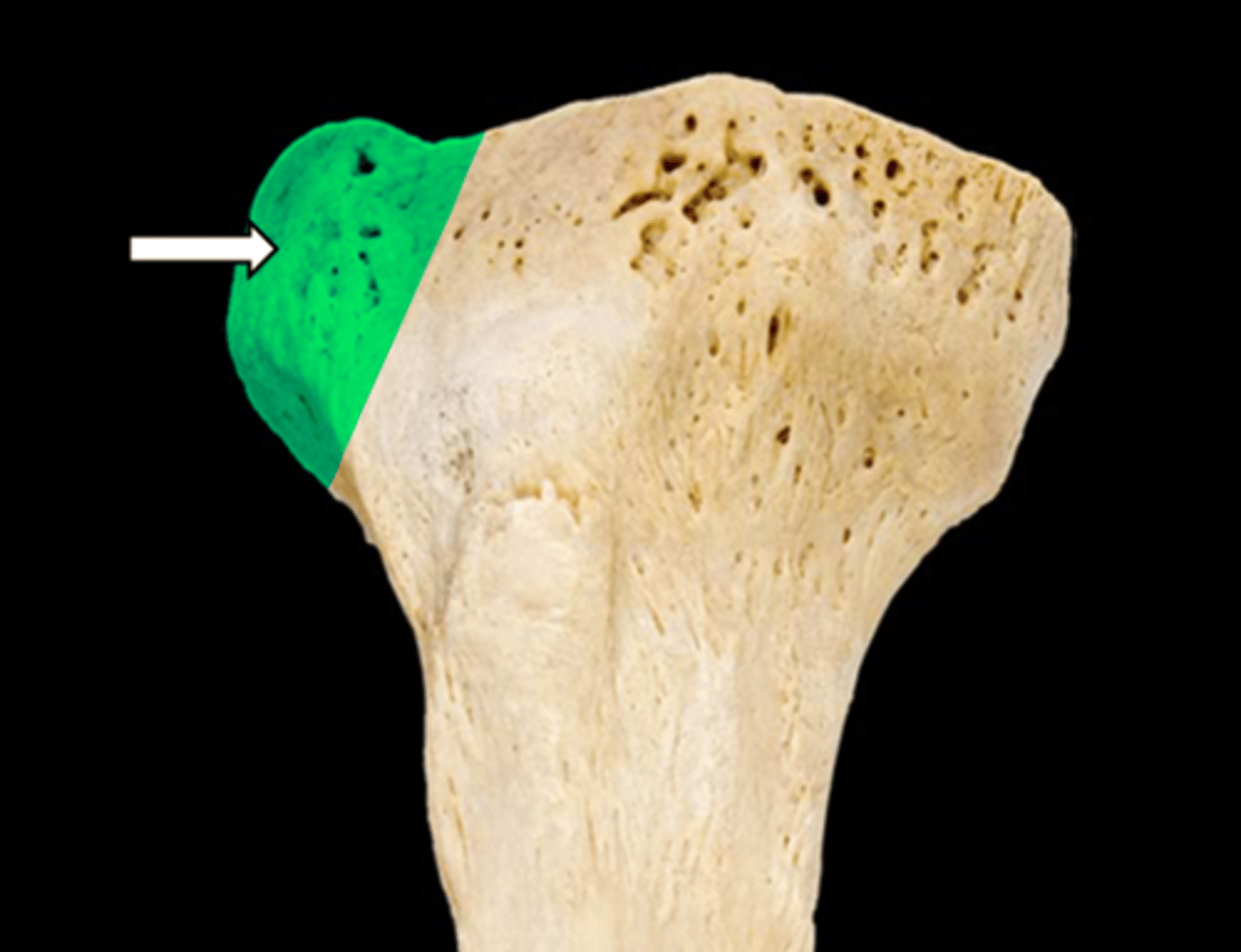<p>name the part</p>