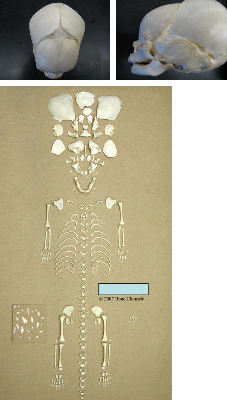 <p>How old was this individual at death?</p>