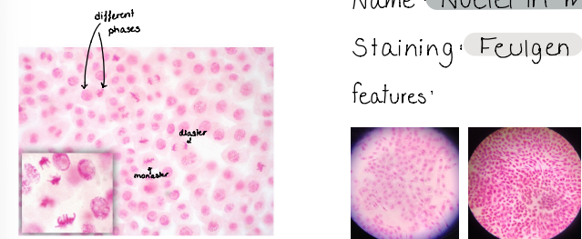<p>Nuclei in mitosis</p><p>staining : fleugen</p>