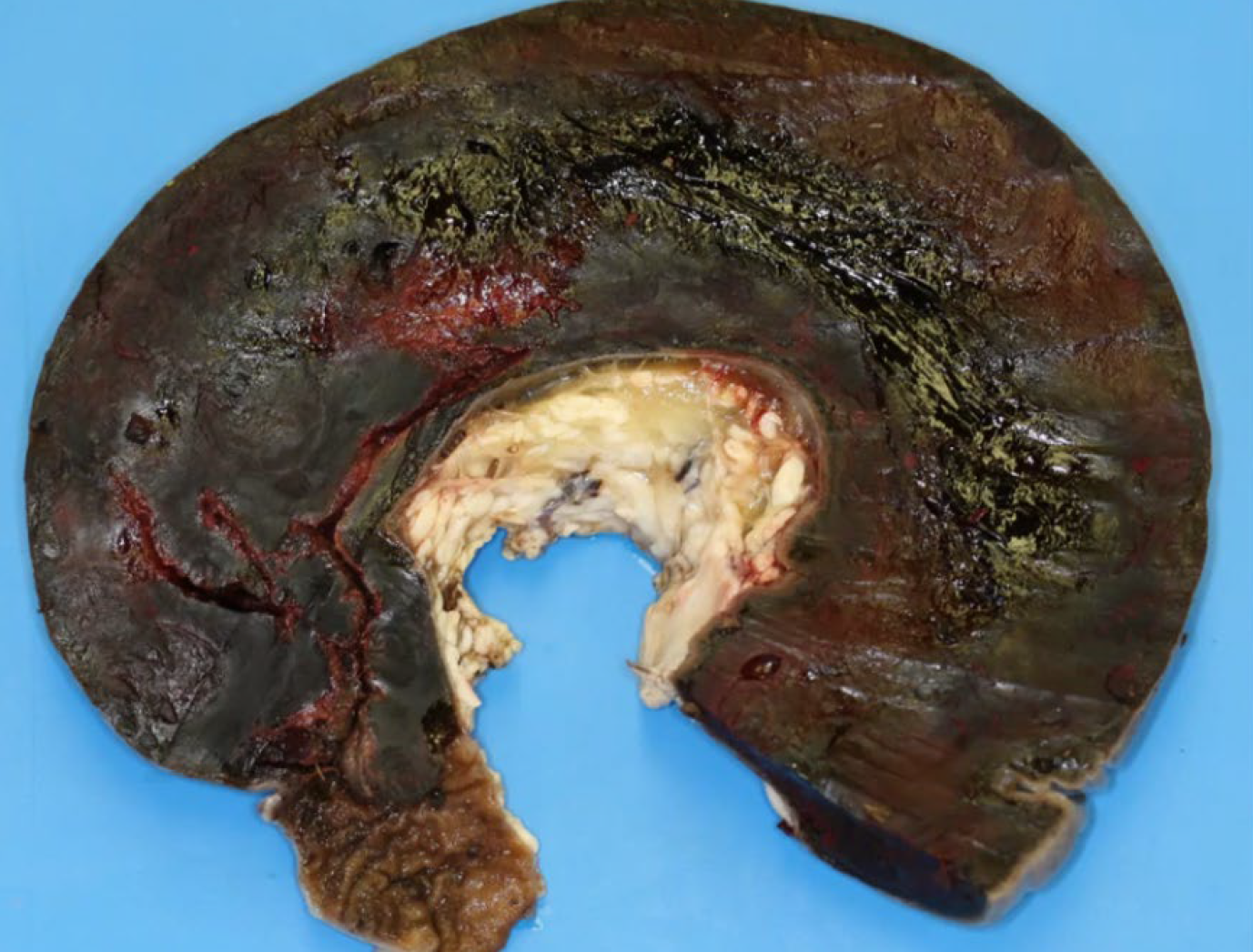 <p>A-Muscularis externa</p><p>B-Muscularis interna</p><p>B-Muscularis mucosae</p><p>C-Lamina propria</p>