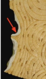 <p>Endosteum</p>