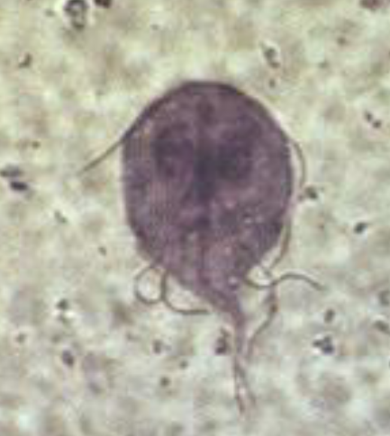 <ul><li><p><span style="font-size: calc(var(--scale-factor)*27.80px)">Sting-ray shaped flagellate with 2 life forms</span></p><ul><li><p><span style="font-size: calc(var(--scale-factor)*24.02px)">Cysts</span></p><ul><li><p>infectious form </p></li><li><p>excreted in stool</p></li><li><p>following infection, excytation in the <u>duodenum and jejunum</u></p></li></ul></li><li><p>Trophozoites </p><ul><li><p>live in <u>duodenum and jejunum</u></p></li><li><p><u>Does NOT invade mucosal epithelium</u></p></li></ul></li></ul></li><li><p><span style="font-size: calc(var(--scale-factor)*27.77px)">Secretory immunoglobulin A antibodies appear to be important for </span><span style="font-size: calc(var(--scale-factor)*27.80px)">humoral immunity</span></p></li></ul><p></p>