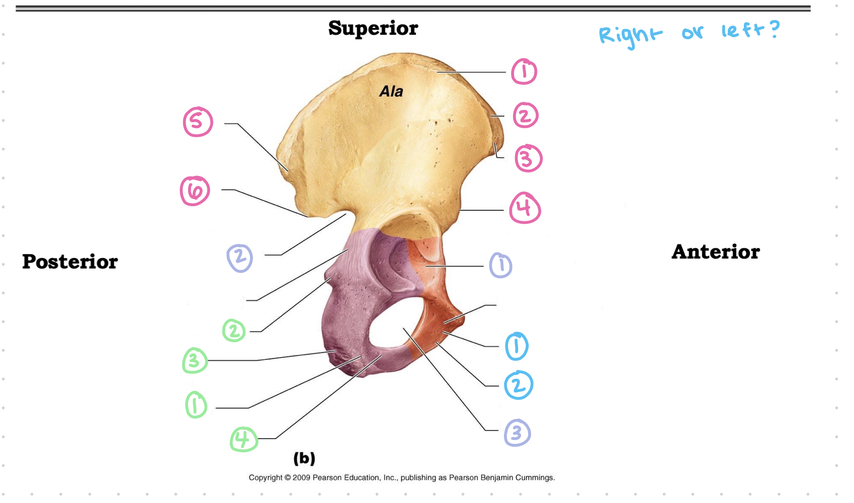 <p>os coxae lateral view - 2 purple</p>