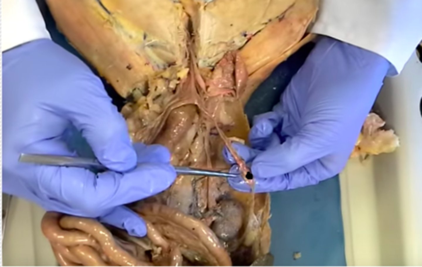 <p>the tube through which an ovum or egg passes from an ovary.</p>