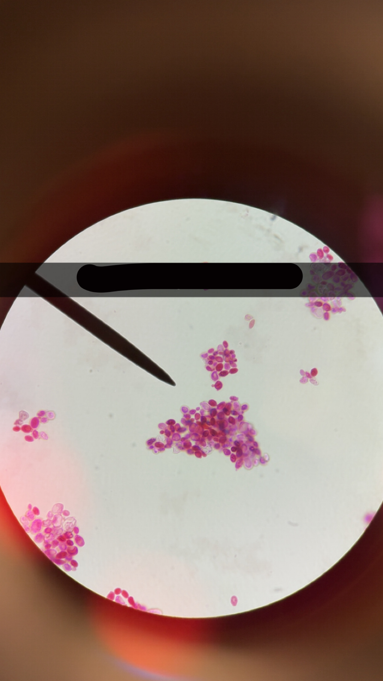 <p>What’s the name of this</p>