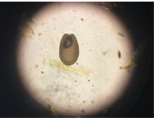 <ul><li><p>causes significant and permanent intestinal damage </p></li><li><p>diagnosis: fecal smears </p></li><li><p>affects mostly <strong>immunocompromised, young, or old animals </strong></p></li><li><p>clinical signs: </p><ul><li><p>lethargy, anorexia, weight loss, <strong>sudden death (hemorrhagic diarrhea) </strong></p></li><li><p><strong>stunting or ill thrift with chronic diarrhea </strong></p></li></ul></li><li><p>treatment: </p><ul><li><p>treat if suspected even if no oocysts are found in feces </p><ul><li><p>amprolium </p></li><li><p>sulfadimethoxine </p></li><li><p>ponazuril </p></li><li><p>decoquinate (added to feed to reduce oocyst production) </p></li></ul></li></ul></li></ul><p></p>