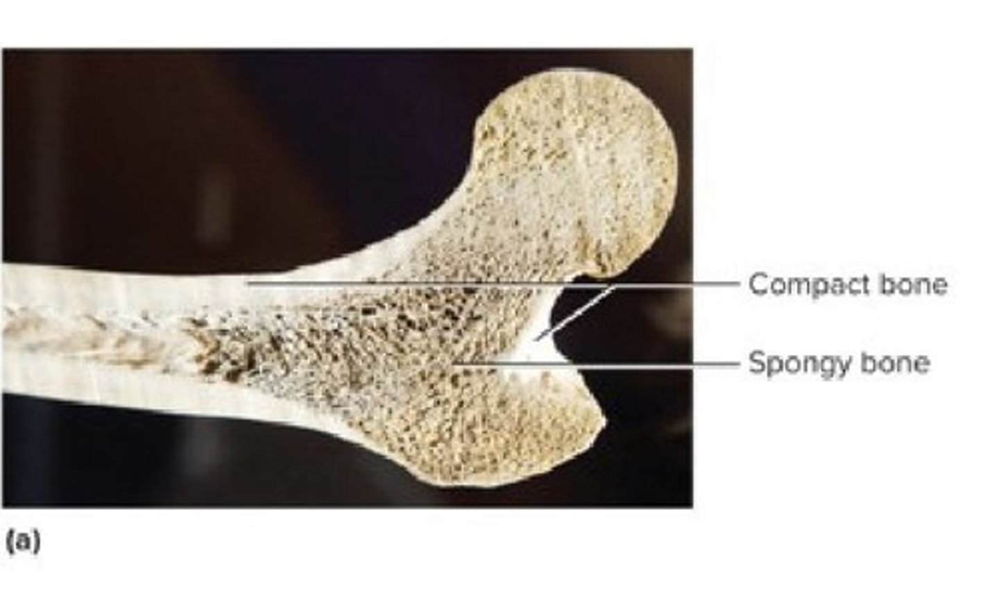 <p>Dense outer layer of bone structure.</p>