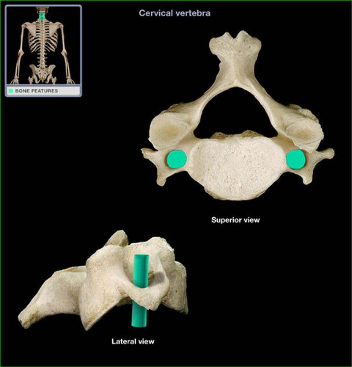 <p>only found in the cervical vertebrae and allow passage of the vertebral artery</p>