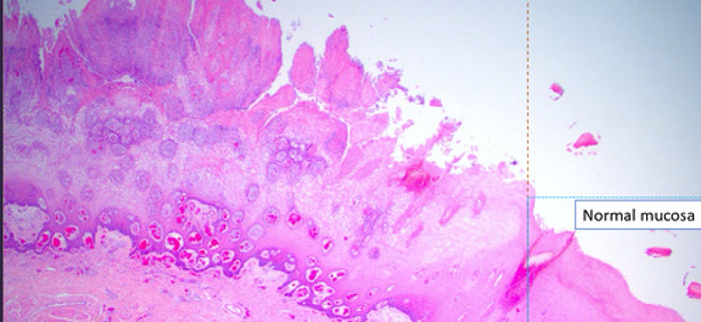 <p>identify the vacuolar degeneration of the cow tongue?</p>