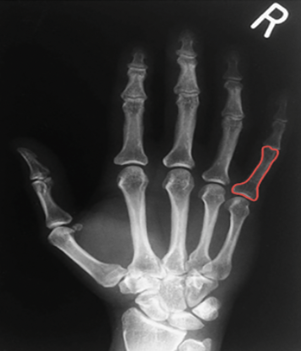 <p>What structure is highlighted?</p>