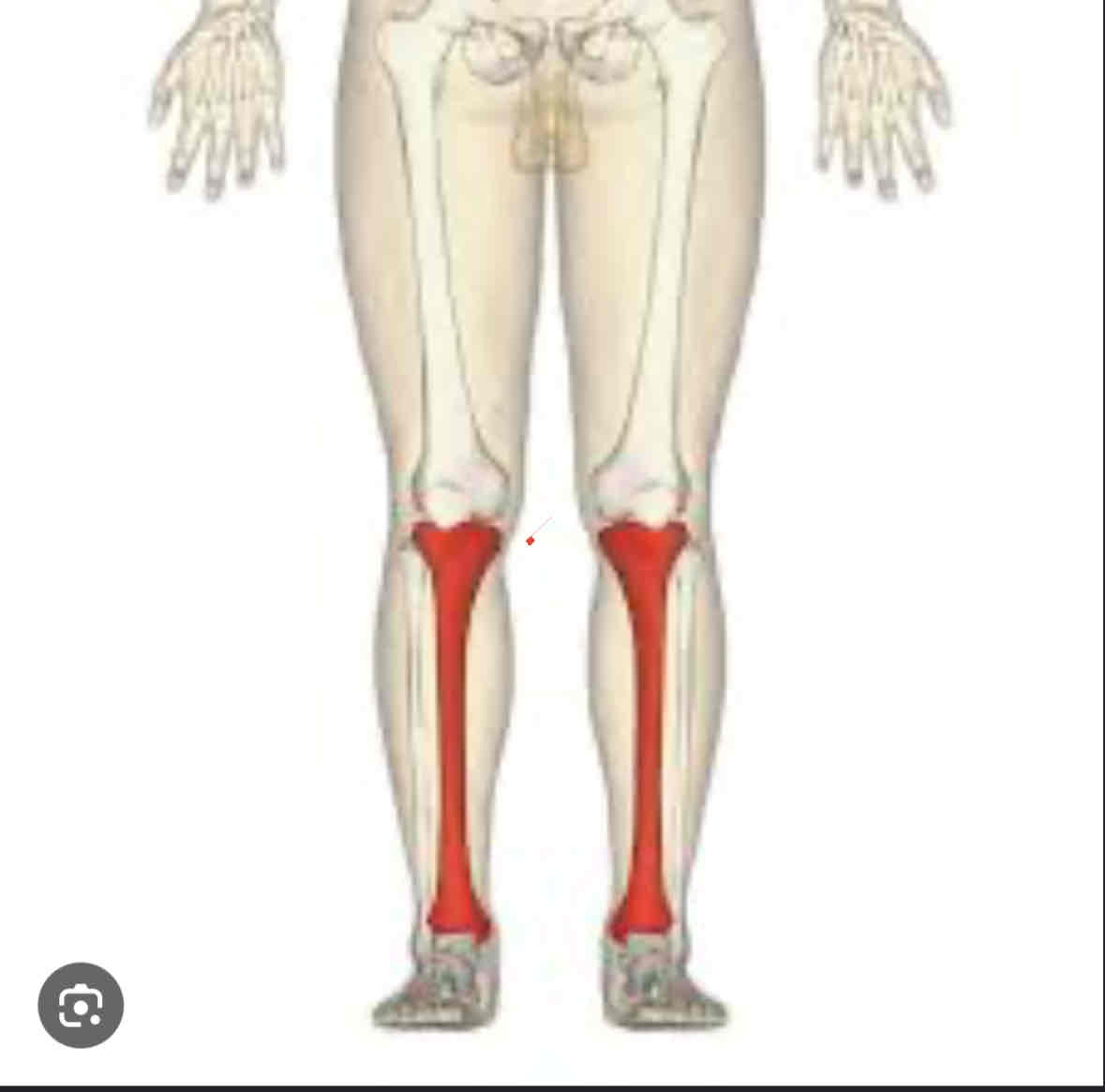 <p>Tibia</p>