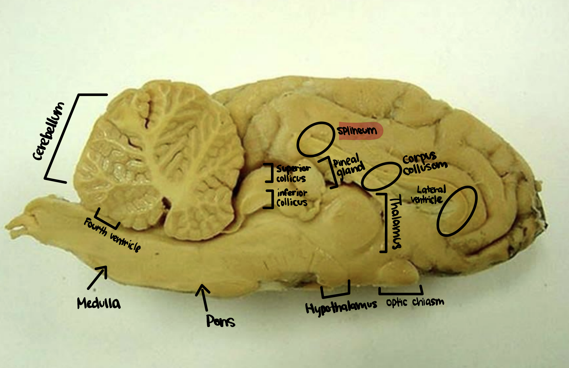 <p>Splineum</p>