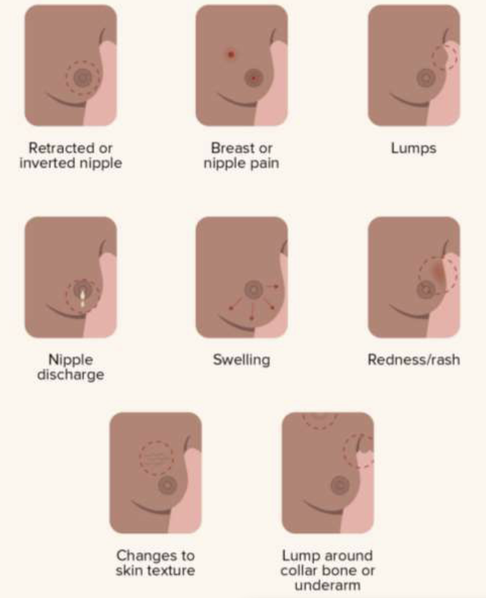 <ul><li><p>retracted or inverted nipple </p></li><li><p>breast or nipple pain </p></li><li><p>lumps </p></li><li><p>nipple discharge </p></li><li><p>swelling </p></li><li><p>redness/rash </p></li><li><p>charges to skin texture </p></li><li><p>lump around collar bone or underarm </p></li></ul><p></p>