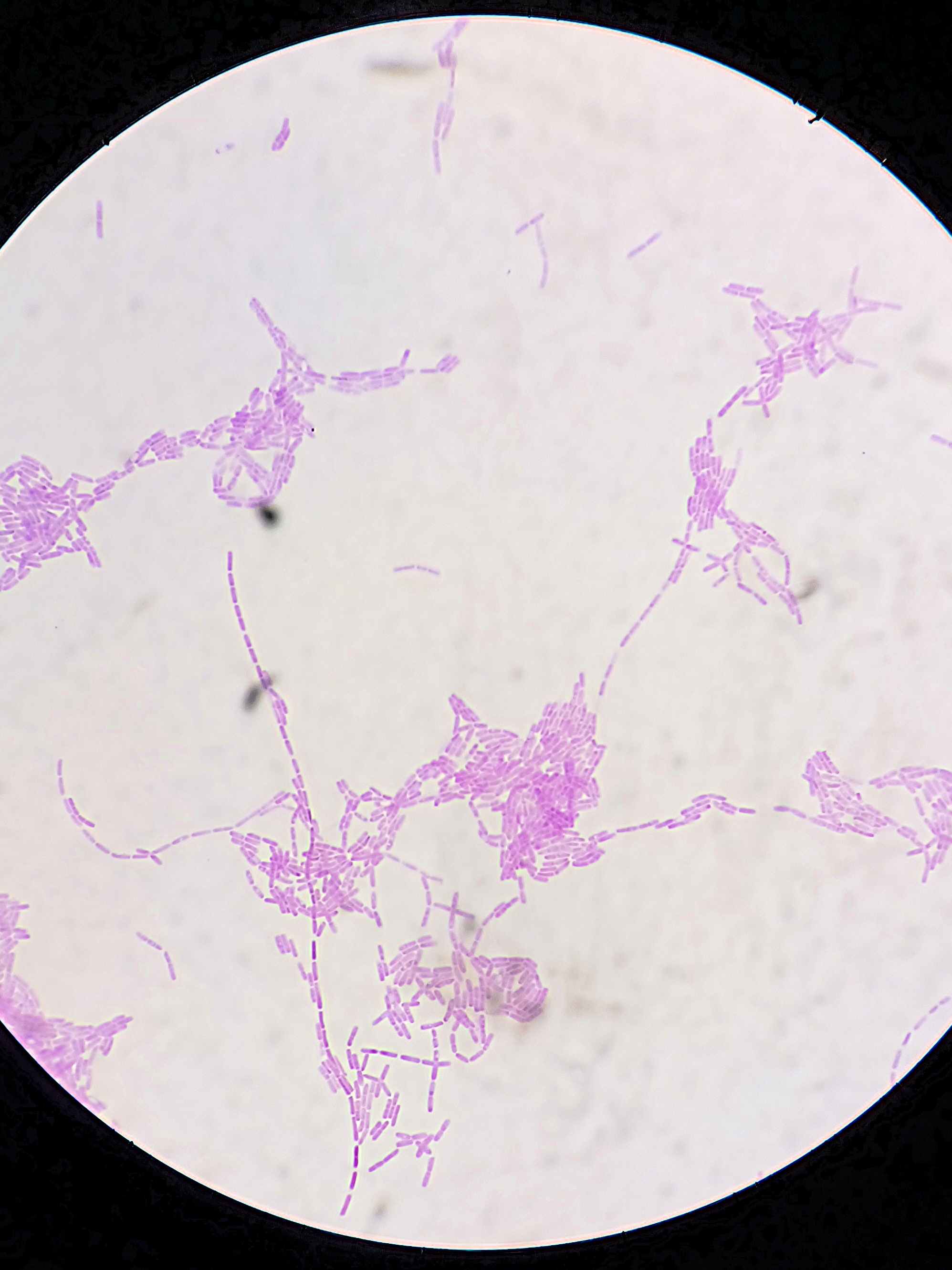 <p><em><mark data-color="#decdff" style="background-color: #decdff; color: inherit">Bacillus subtilis</mark></em></p><ul><li><p><span style="font-family: Arial, sans-serif">Rod-shaped (bacilli)</span></p></li><li><p><span style="font-family: Arial, sans-serif">Single or in chains</span></p></li><li><p><span style="font-family: Arial, sans-serif">4.0 to 10.0 micrometers</span></p></li><li><p><span style="font-family: Arial, sans-serif">Purple or blue (Gram-positive)</span></p></li><li><p>Non-pathogenic bacteria found in the soil or the human gut. It is usually used for probiotic and food production.</p></li></ul><p></p>