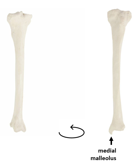 <p>What bone is this?</p>