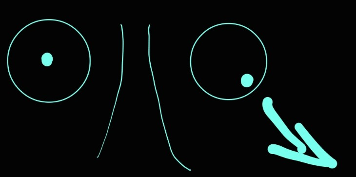 <p>cranial nerve IV</p>